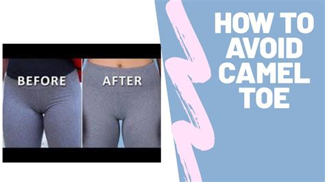 how to get rid of camel toe|How To Get Rid Of A Camel Toe: Prevention, Remedies, And